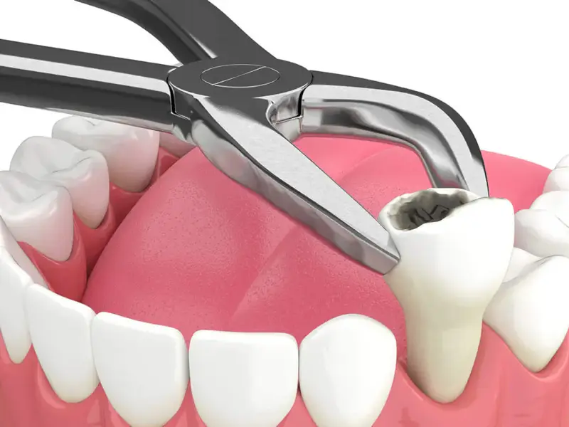 Oral surgery operatory at Missouri City Dentistry