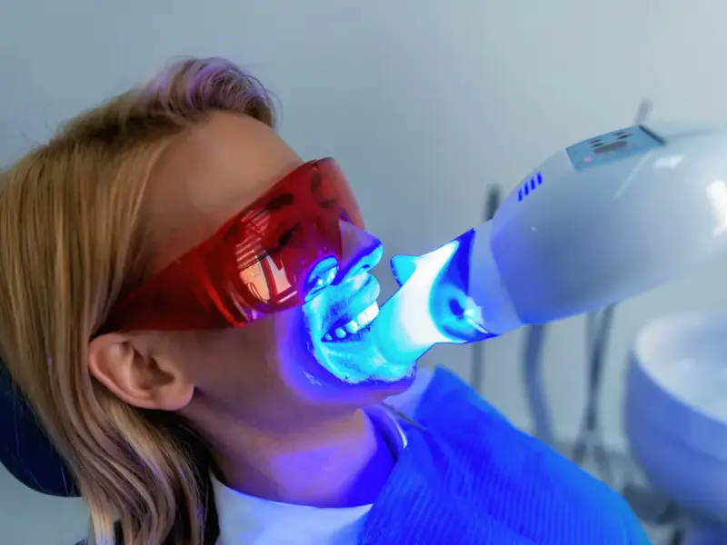 Bright smile after professional whitening at Missouri City Dentistry