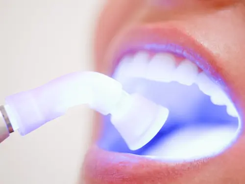 Soft Tissue Laser treatments available at Missouri City Dentistry in Missouri City, TX